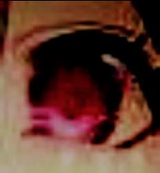 611176 B
