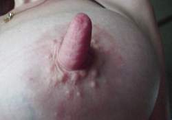 17091 B