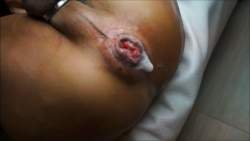 28005 B