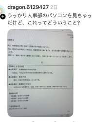 75017 B