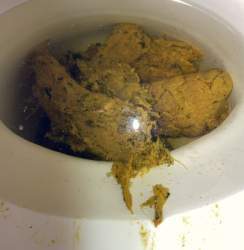 7181 B