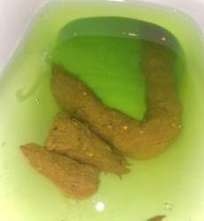 5240 B