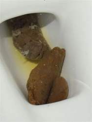 8886 B