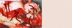 70899 B