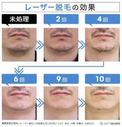 66419 B