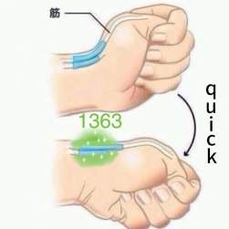 78296 B
