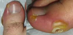 1085169 B